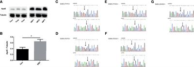 Increased ApoE Expression in Follicular Fluid and the ApoE Genotype Are Associated With Endometriosis in Chinese Women